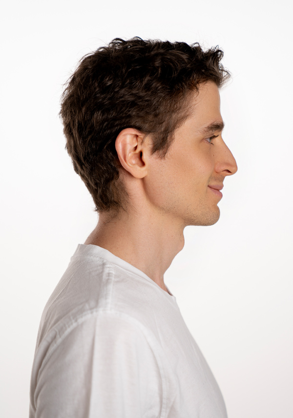 SuperSkin-V-Super Thin Skin Hair System Toupee