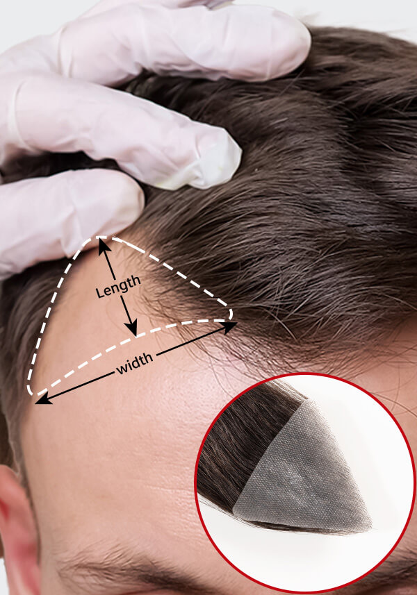 Temple Hair Patch for Men