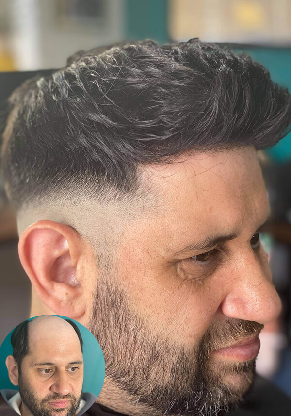 0.03mm Ultra Thin Skin Hairpiece