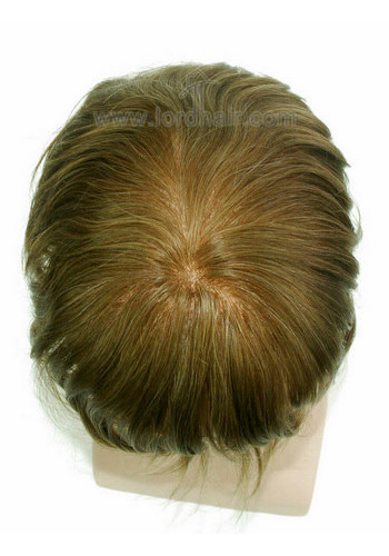yj106 hair replacement system