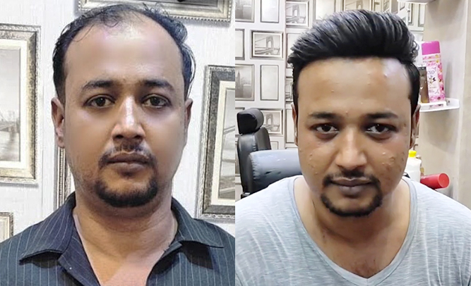 Lace hair system transformation