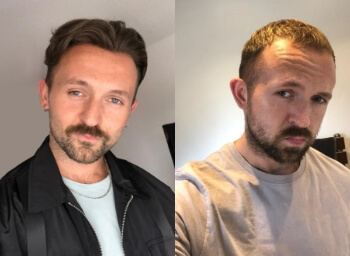 lordhair