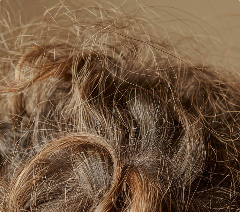 Dry, frizzy hair