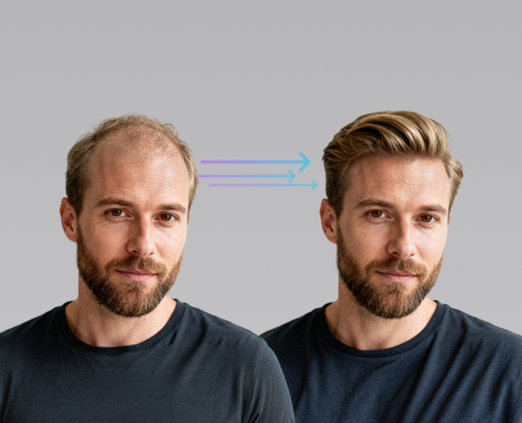 Lordhair Activity AI