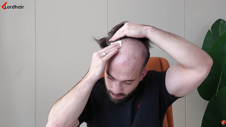 Watch how to remove a hair system