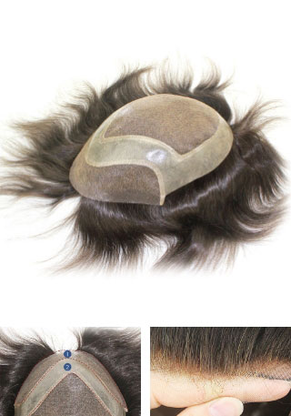Fine Welded Mono with Skin Gauze Perimeter Hair Replacement System