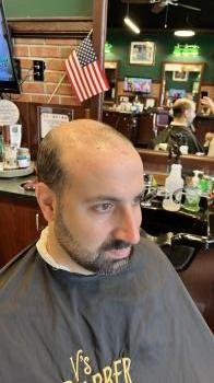 skin hair system