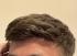 high-quality hair system