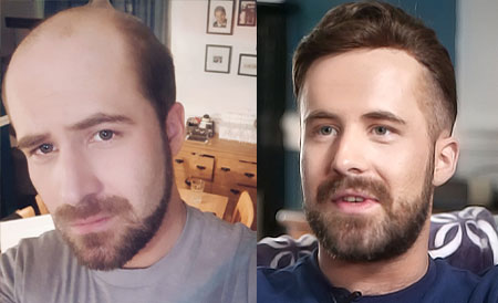 Lordhair Champion