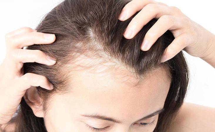 traction alopecia