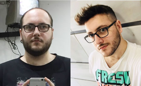 super thin skin hairpieces for men
