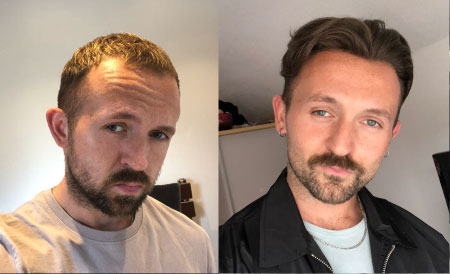 Men's toupee Men's toupee