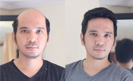 Ultra thin skin hairpiece Ultra thin skin hairpiece