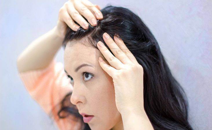 women hair thinning disease