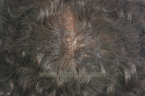 all thin skin hair system all thin skin hair system