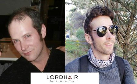 Men's toupee, hair systems