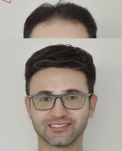 Mens-partial-wig