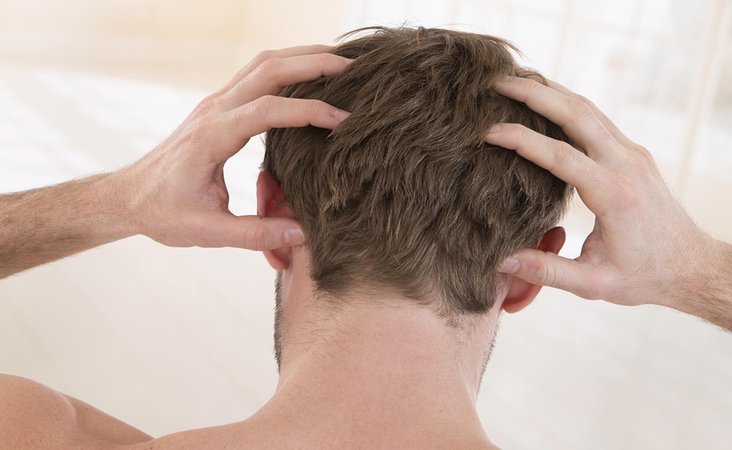Symptoms of baldness