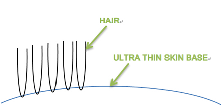 V looped ventilation