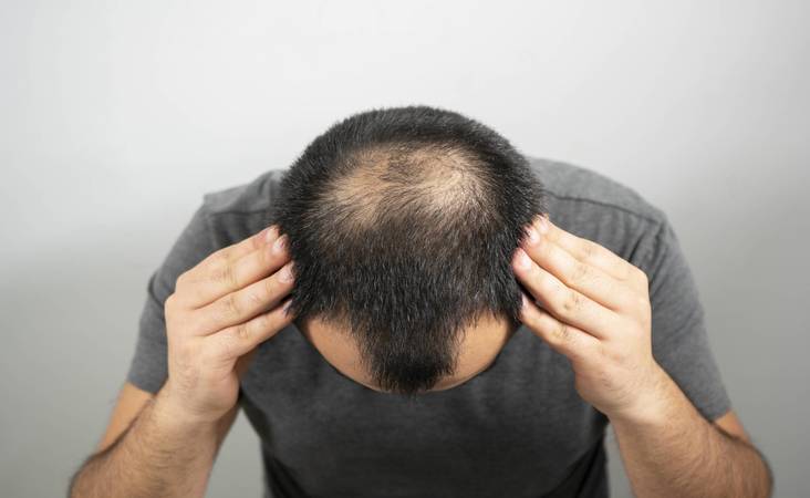 mens hair systems