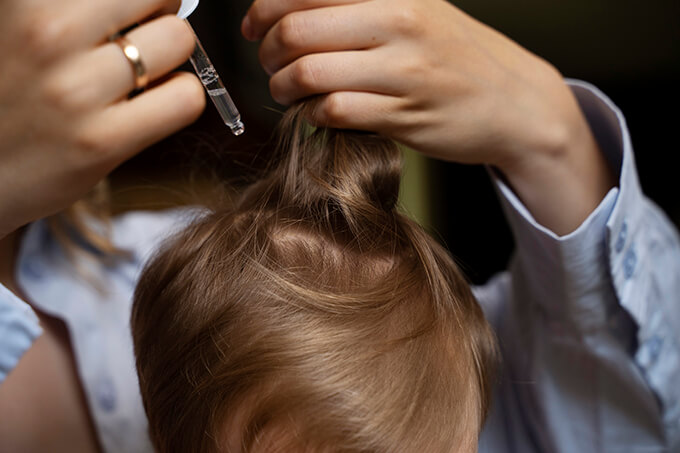 Hair System Shedding