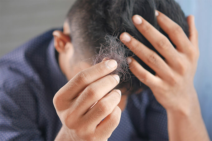 How to handle hair system emergencies