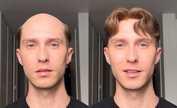 hair system for men