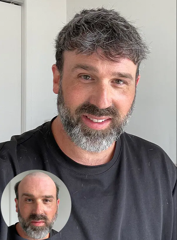 Lite Cosmos Hairpiece