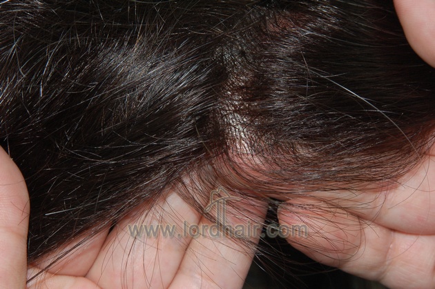 fine welded mono double layer perimeter thin skin front