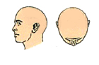 full cap hair replacement