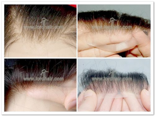 Invisible Hairline of Lace Hair System