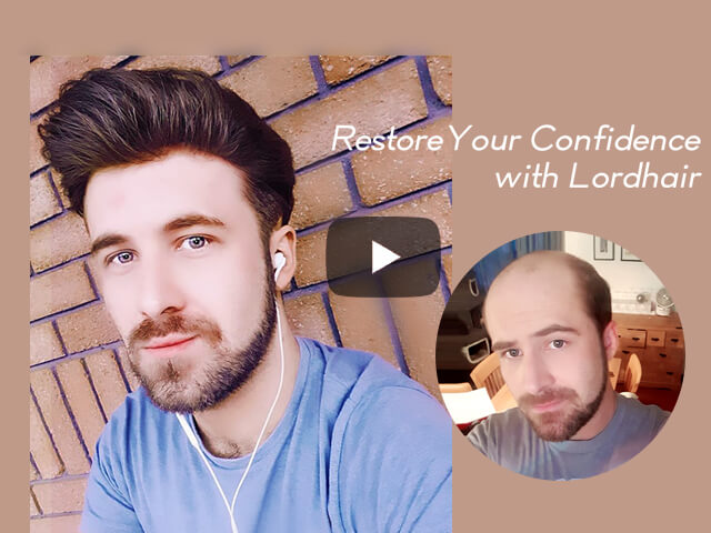 Change Your Life with Lordhair Non-surgical Hair Thickening