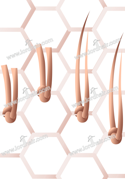 hair system knot hair system knot