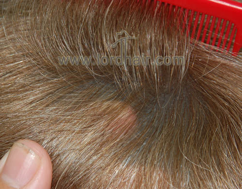 super thin skin flat injected hairpiece